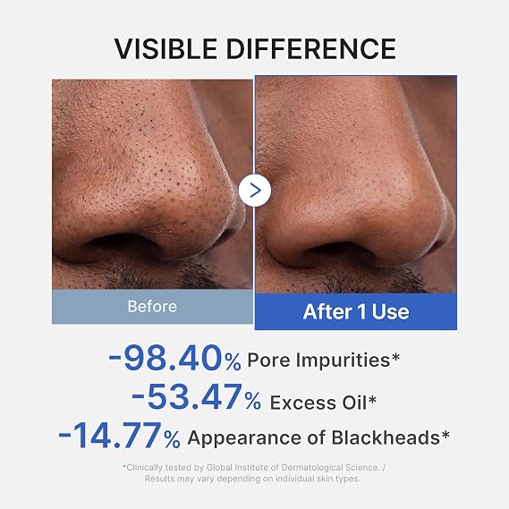 Medicube Zero Pore Blackhead MUD Mask - 100g