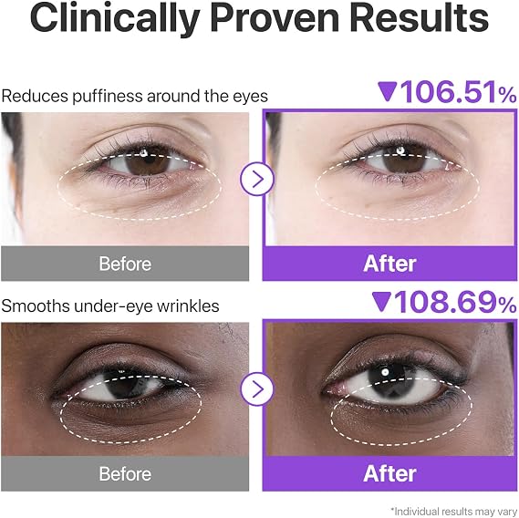 Numbuzin No.9 NAD+ Eye Patches | Depuffing & Brightening