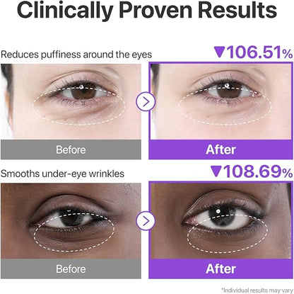 Numbuzin No.9 NAD+ Eye Patches | Depuffing & Brightening