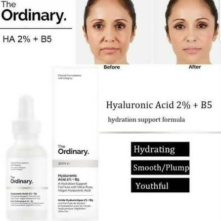 The Ordinary Hyaluronic Acid 2% + B5 - 30ml